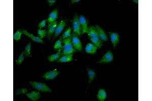 Immunofluorescence staining of Hela cells with ABIN7155501 at 1:133, counter-stained with DAPI. (WHSC1 antibody  (AA 1-44))
