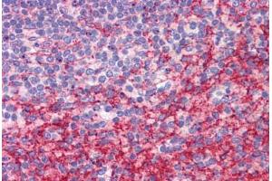 Human Spleen: Formalin-Fixed, Paraffin-Embedded (FFPE) (ATG9B antibody  (C-Term))