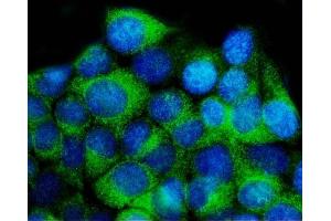 IF analysis of YWHAE using anti-YWHAE antibody (ABIN7599166). (YWHAE antibody  (AA 1-255))