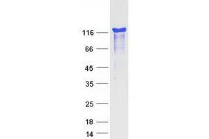 Validation with Western Blot (HDGFRP2 Protein (Transcript Variant 2) (Myc-DYKDDDDK Tag))