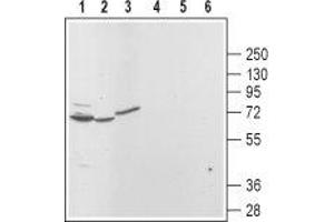 Western blot analysis of rat brain (lanes 1 and 4), kidney (lanes 2 and 5) and pancreas (lanes 3 and 6): - 1,2,3.