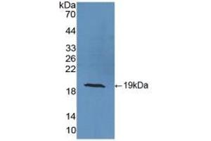Detection of Recombinant SOD1, Ovine using Polyclonal Antibody to Superoxide Dismutase 1 (SOD1) (SOD1 antibody  (AA 2-152))