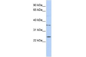 IQCF1 antibody used at 1 ug/ml to detect target protein. (IQCF1 antibody  (Middle Region))