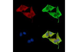 ABIN7096821 and ABIN7100887 staining HepG2 cells by IF/ICC.