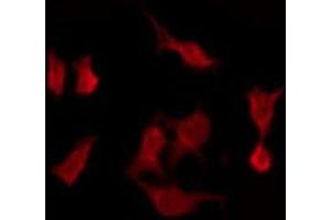 ABIN6275454 staining HeLa by IF/ICC. (RASL10A antibody  (Internal Region))