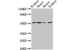 Western Blot Positive WB detected in: Rat kidney tissue, Mouse heart tissue, Mouse brain tissue, Mouse kidney tissue All lanes: NDUFS2 antibody at 6. (NDUFS2 antibody  (AA 297-427))