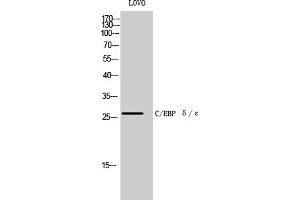 Western Blot analysis of LOVO cells using C/EBP δ/ε Polyclonal Antibody diluted at 1:500. (C/EBP delta/epsilon (AA 140-220) antibody)