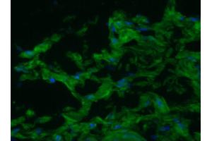 Image no. 2 for anti-Smoothelin (SMTN) antibody (ABIN335397) (Smoothelin antibody)