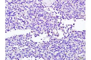 Paraformaldehyde-fixed, paraffin embedded human spleen tissue, Antigen retrieval by boiling in sodium citrate buffer(pH6) for 15min, Block endogenous peroxidase by 3% hydrogen peroxide for 30 minutes, Blocking buffer (normal goat serum) at 37°C for 20min, Antibody incubation with Rabbit Anti-NCR2 Polyclonal Antibody, Unconjugated  at 1:400 overnight at 4°C, followed by a conjugated secondary and DAB staining (NKp44/NCR2 antibody  (AA 201-276))