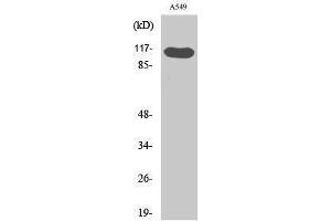 Western Blotting (WB) image for anti-HRS (HRS) (pTyr216) antibody (ABIN3172906) (HRS (HRS) (pTyr216) antibody)