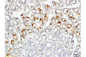 Formalin-fixed and paraffin embedded rat colon tissue labeled with Rabbit Anti-Leptin receptor(long) Polyclonal Antibody (ABIN725060) at 1:200 followed by conjugation to the secondary antibody and DAB staining. (Leptin Receptor antibody  (AA 901-1000))