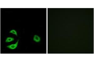 Immunofluorescence analysis of A549 cells, using ACOT8 Antibody. (ACOT8 antibody  (AA 131-180))