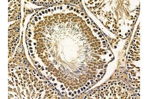 ABIN7095646 and ABIN7099708 at 1/100 staining rat testis tissue by IHC-P. (C16orf80 antibody)