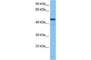 Western Blotting (WB) image for anti-Transcription Factor AP-2 beta (Activating Enhancer Binding Protein 2 Beta) (TFAP2B) (N-Term) antibody (ABIN2780495)