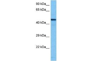 Host:  Mouse  Target Name:  TFAP2B  Sample Tissue:  Mouse Kidney  Antibody Dilution:  1ug/ml (TFAP2B antibody  (N-Term))