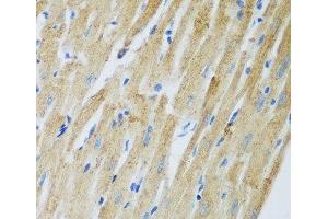 Immunohistochemistry of paraffin-embedded Rat heart using ADAM12 Polyclonal Antibody at dilution of 1:100 (40x lens). (ADAM12 antibody)