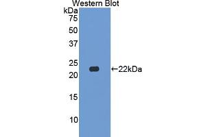 Western blot analysis of the recombinant protein. (CSN2 antibody  (AA 41-198))