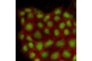 Immunofluorescenitrocellulosee of human MCF7 cells stained with Phalloidin-TRITC (Red) for Actin staining and monoclonal anti-human MAPK1 antibody (1:500) with Alexa 488 (Green). (ERK2 antibody)