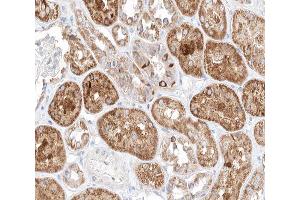 ABIN6266642 at 1/100 staining human kidney tissue sections by IHC-P. (TGFB3 antibody)