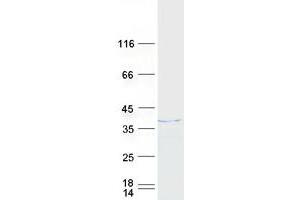 HNRNPH3 Protein (Myc-DYKDDDDK Tag)