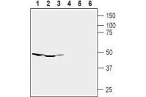 Western blot analysis of rat brain (lanes 1 and 4), mouse brain (lanes 2 and 5) membranes and human brain neuroblastoma (SH-SY5Y) (lanes 3 and 6) cell lysate:1-3.