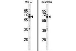 (LEFT) Western blot analysis of PANK1 antibody (N-term) in MCF-7 cell line lysates (35ug/lane). (PANK1 antibody  (N-Term))