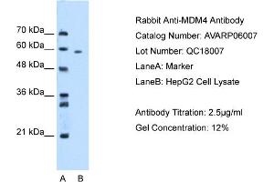 WB Suggested Anti-MDM4 AntibodyTitration: 2. (MDM4-binding Protein antibody  (N-Term))