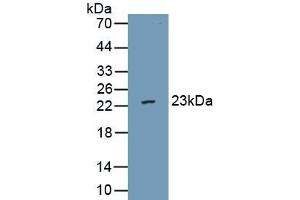 Detection of Recombinant vWA5B2, Human using Polyclonal Antibody to Von Willebrand Factor A Domain Containing Protein 5B2 (vWA5B2) (VWA5B2 antibody  (AA 354-527))
