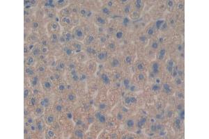 Used in DAB staining on fromalin fixed paraffin- embedded liver tissue (Tec Protein Tyrosine Kinase (TEC) (AA 369-622) antibody)