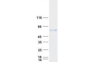 Validation with Western Blot (MEIS2 Protein (Transcript Variant A) (Myc-DYKDDDDK Tag))