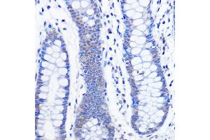 Immunohistochemistry of paraffin-embedded human colon using AhR Rabbit mAb (ABIN7265679) at dilution of 1:100 (40x lens). (Aryl Hydrocarbon Receptor antibody)