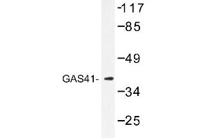 Image no. 1 for anti-YEATS Domain Containing 4 antibody (ABIN272151) (GAS41 antibody)