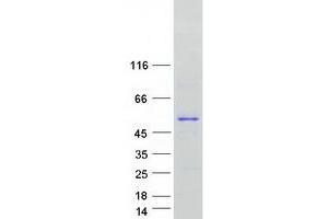 Western Blotting (WB) image for Ataxin 3 (ATXN3) (Transcript Variant 1) protein (Myc-DYKDDDDK Tag) (ABIN2715017)