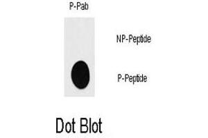 Dot blot analysis of RPS6KB1 (phospho S418) polyclonal antibody  on nitrocellulose membrane. (RPS6KB1 antibody  (pSer418))