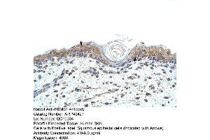 Rabbit Anti-RBMS1 Antibody  Paraffin Embedded Tissue: Human Skin Cellular Data: Squamous epithelial cells Antibody Concentration: 4. (RBMS1 antibody  (C-Term))