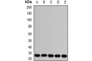 Western blot analysis of RAB17 expression in Jurkat (A), A431 (B), mouse brain (C), mouse kidney (D), rat liver (E) whole cell lysates.