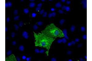 Anti-KIAA1609 mouse monoclonal antibody (ABIN2453206) immunofluorescent staining of COS7 cells transiently transfected by pCMV6-ENTRY KIAA1609 (RC209287). (KIAA1609 antibody)