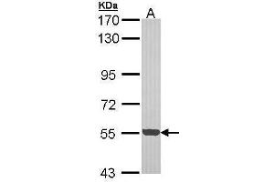 WB Image Sample (30 ug of whole cell lysate) A: Hep G2 , 7. (CDK18 antibody)