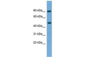 Image no. 1 for anti-Mediator Complex Subunit 25 (MED25) (AA 33-82) antibody (ABIN6745504)