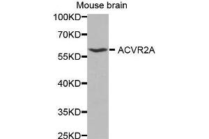 Western Blotting (WB) image for anti-Activin A Receptor, Type IIA (ACVR2A) (AA 20-140) antibody (ABIN6219141) (ACVR2A antibody  (AA 20-140))