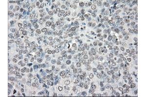Immunohistochemical staining of paraffin-embedded colon tissue using anti-PPP5Cmouse monoclonal antibody. (PP5 antibody)