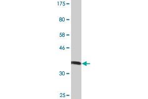 Western Blot detection against Immunogen (36. (MGAT5 antibody  (AA 642-739))