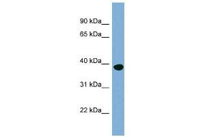 OAS1 antibody used at 1 ug/ml to detect target protein. (OAS1 antibody  (N-Term))