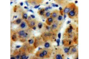 Used in DAB staining on fromalin fixed paraffin-embedded Liver tissue (ADAMTS7 antibody  (AA 1589-1686))