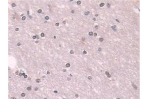 Immunohistochemistry (IHC) image for anti-Transketolase (TKT) (AA 1-294) antibody (ABIN7436402)