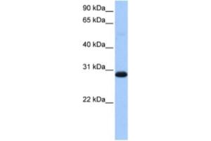 Western Blotting (WB) image for anti-Tryptophanyl tRNA Synthetase 2, Mitochondrial (WARS2) antibody (ABIN2463510) (WARS2 antibody)
