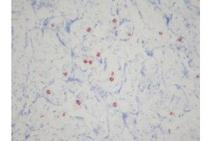 Immunohistochemistry (IHC) image for anti-CD16 (CD16) antibody (ABIN781725) (CD16 antibody)