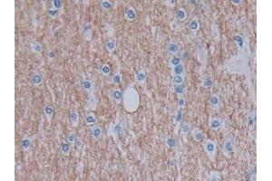 Detection of GHRH in Human Cerebrum Tissue using Monoclonal Antibody to Growth Hormone Releasing Hormone (GHRH) (GHRH antibody  (AA 19-108))