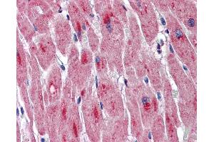 Immunohistochemistry (IHC) image for anti-Dystrophia Myotonica-Protein Kinase (DMPK) (Middle Region) antibody (ABIN2775281) (DMPK antibody  (Middle Region))