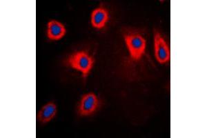 Immunofluorescent analysis of TPL2 (pT290) staining in HepG2 cells. (MAP3K8 antibody  (pSer290))